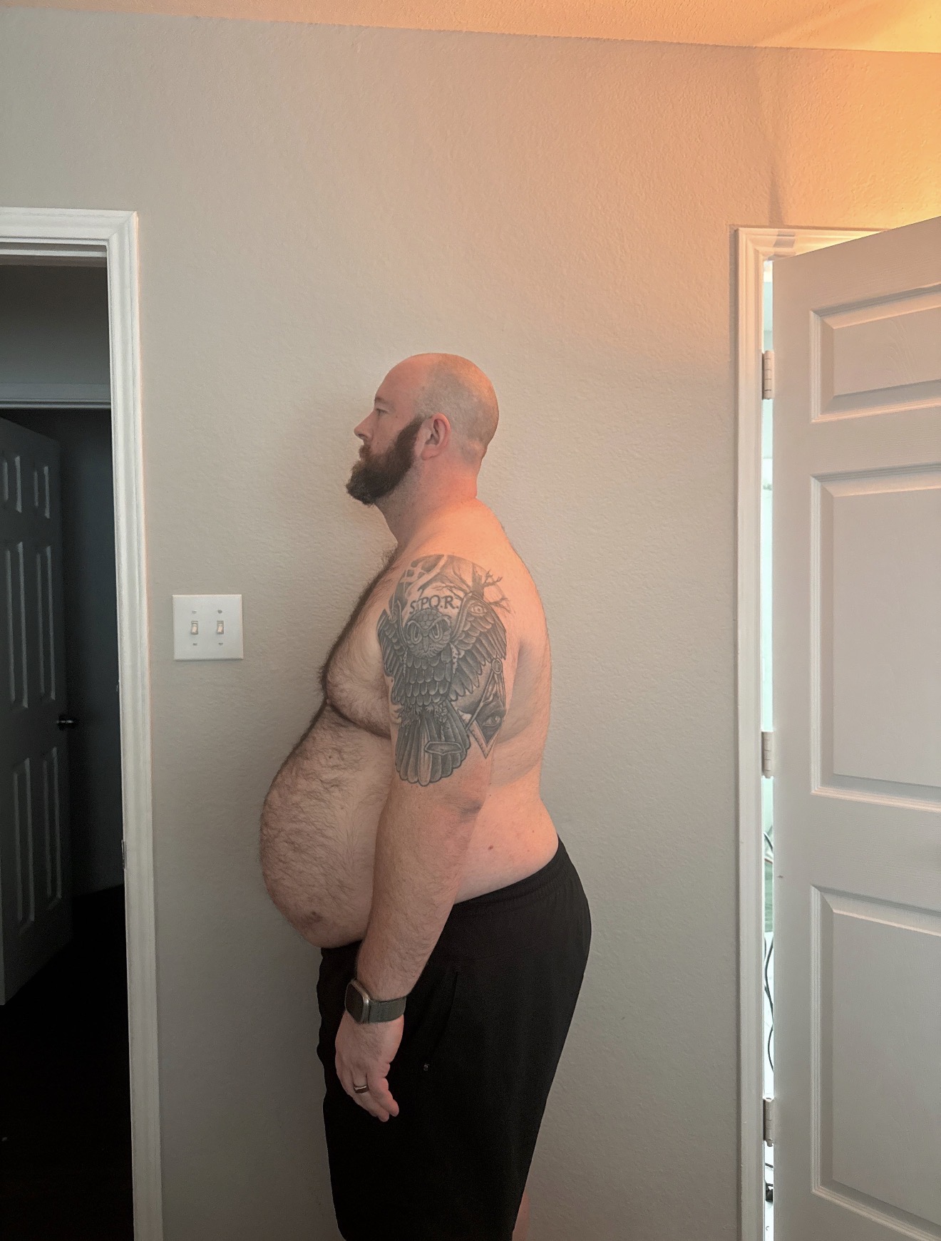 Tyler A. before