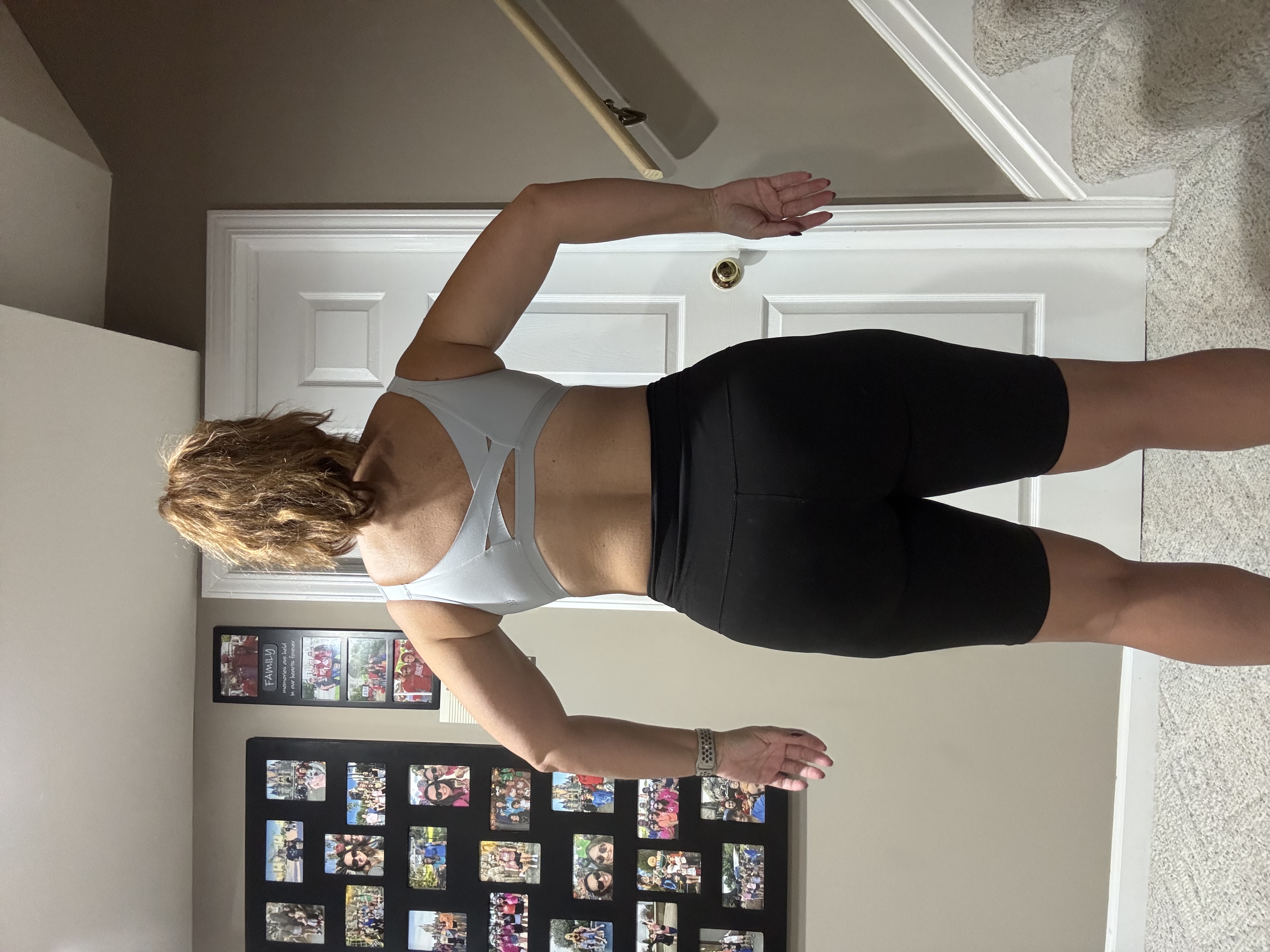 Ashley H. before